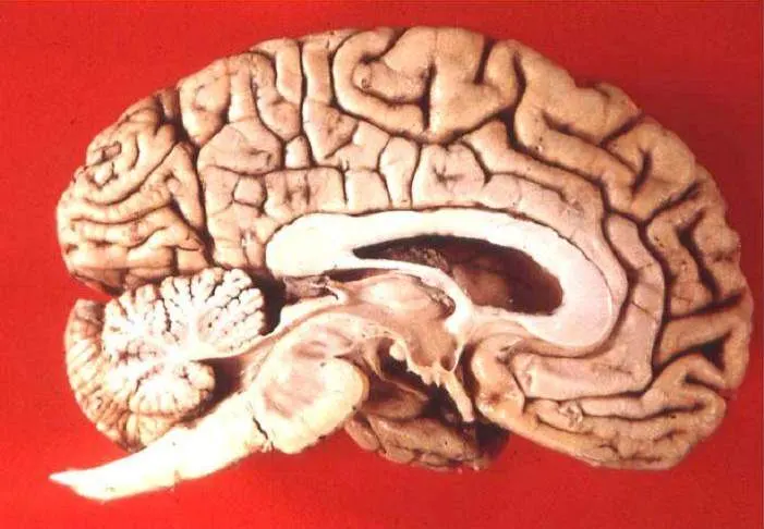A human brain cut in half down the middle, shown against a red background.